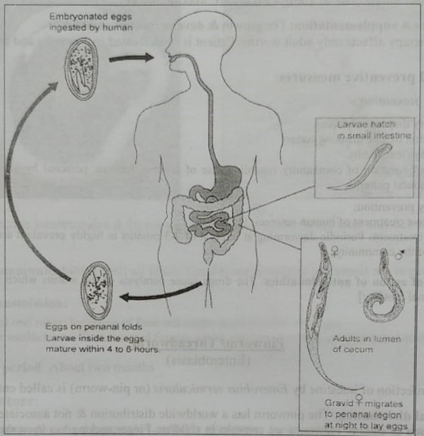 Definition of Pinworm