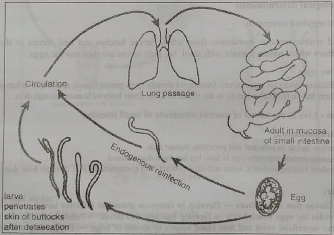 Definition of Strongyloidiasis