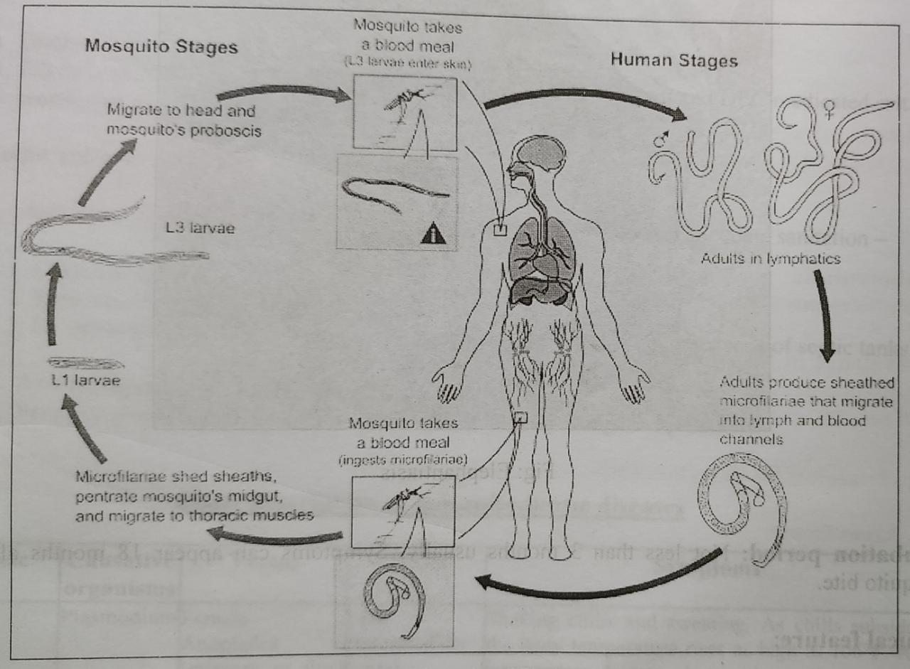 Lymphatic filariasis