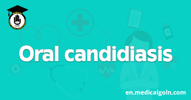 Oral candidiasis