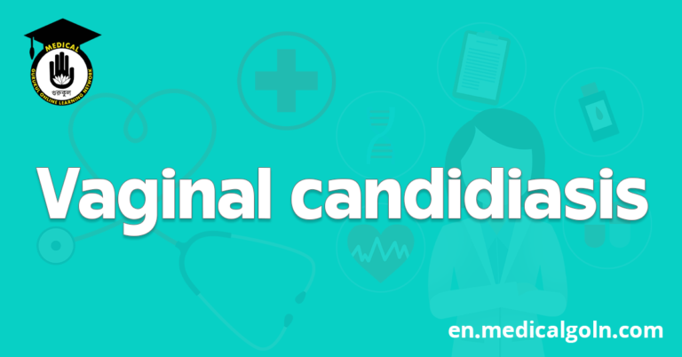 Vaginal candidiasis